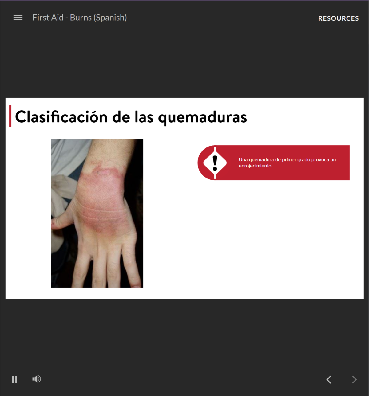 First Aid: Burns - Spanish - SafetyNow