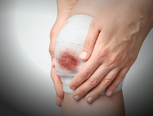 First Aid – Soft Tissue Injuries - Spanish