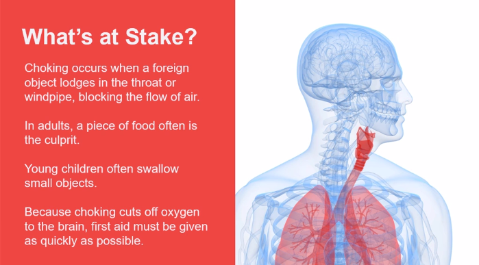 First Aid - Choking - Image 2
