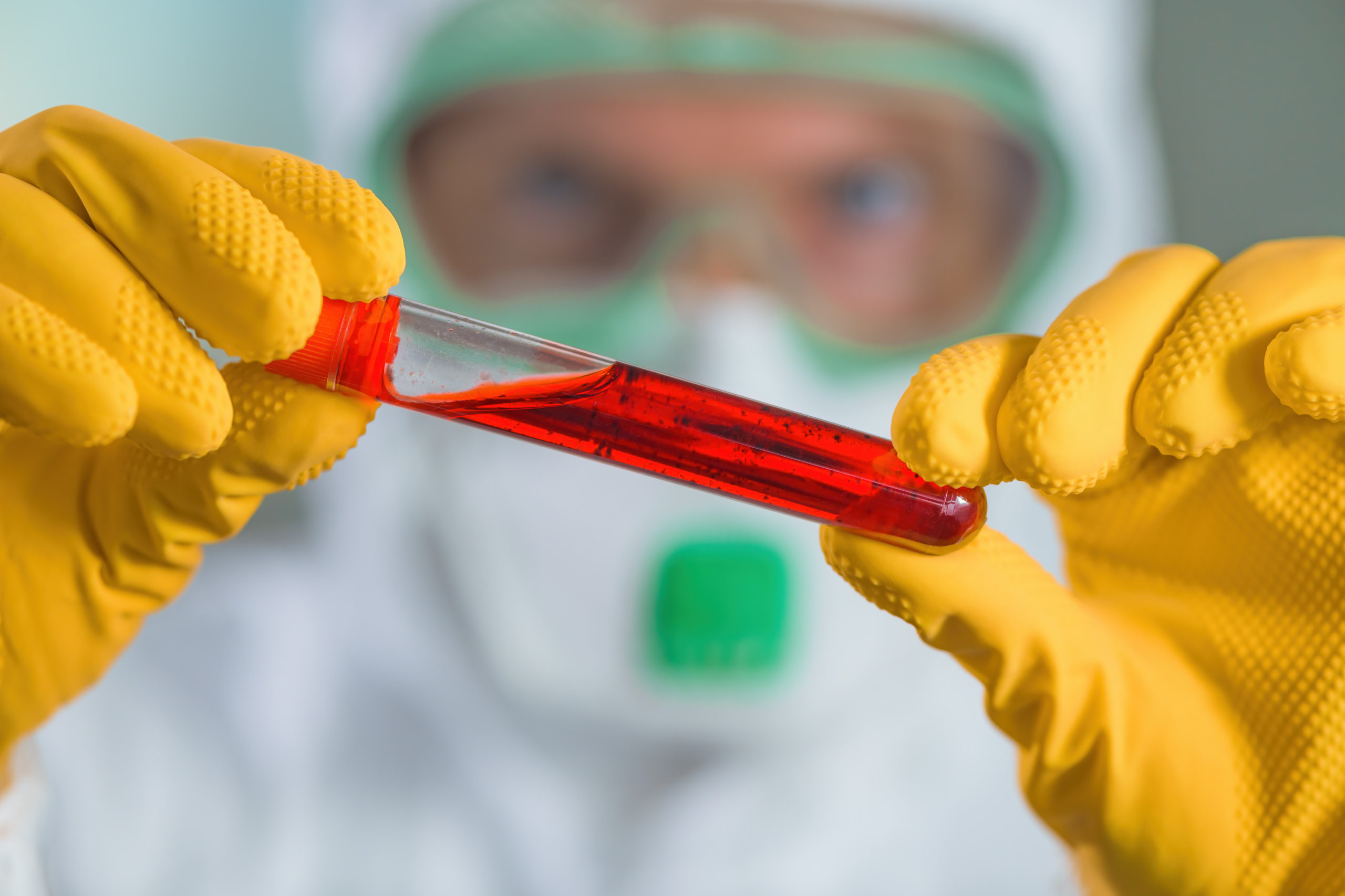 REFRESHER: BBP - Bloodborne Pathogens - Image 3