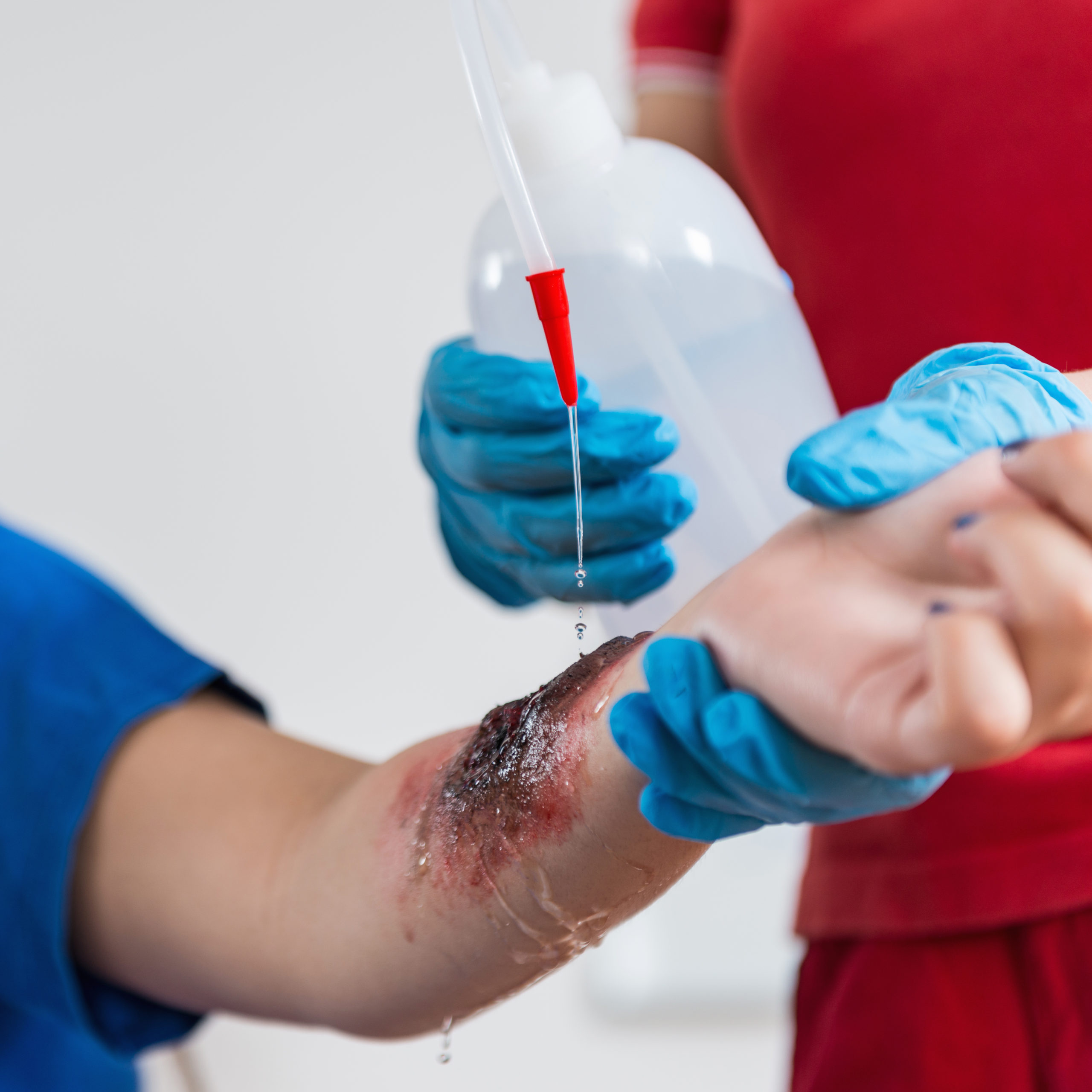 First Aid - Chemical Burns And Liquid Gas Burns - Image 3
