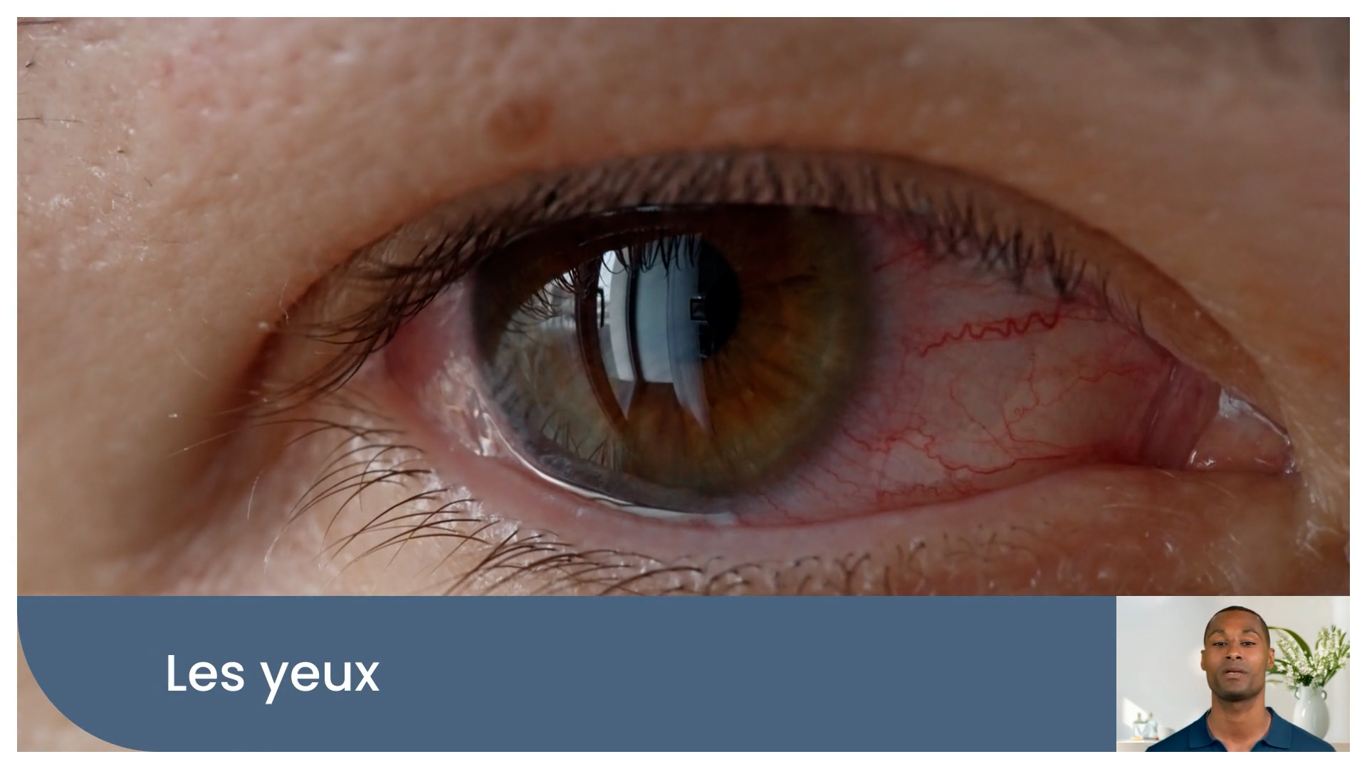 Formaldehyde Safety: Staying Safe Around a Hidden Hazard - French - Image 4