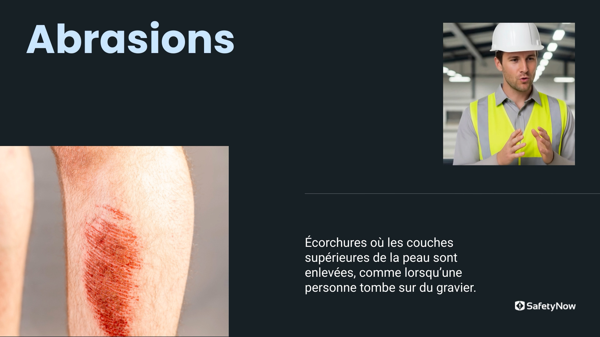First Aid – Soft Tissue Injuries - French - Image 3