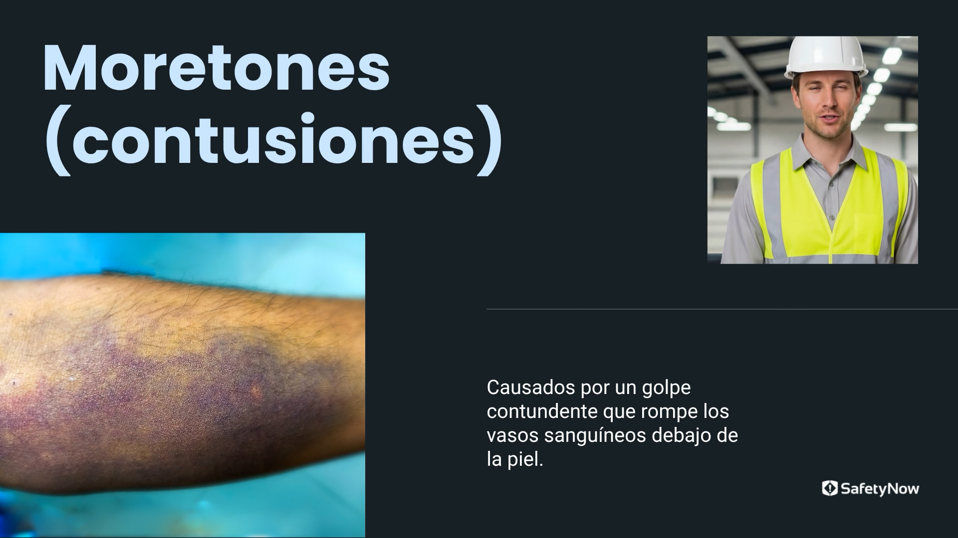 First Aid – Soft Tissue Injuries - Spanish - Image 3